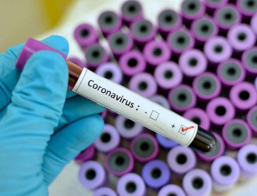 Covid-19 en RDC: 1.105 nouveaux cas confirmés en une journée